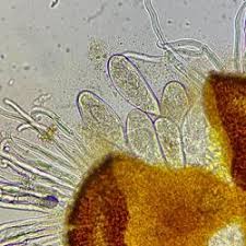 Attēlu rezultāti vaicājumam “Sawadaea tulasnei”