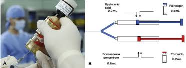 Image result for BMAC