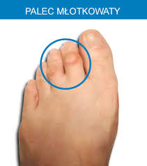 Znalezione obrazy dla zapytania palec