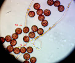 Attēlu rezultāti vaicājumam “Diderma floriforme stalked”
