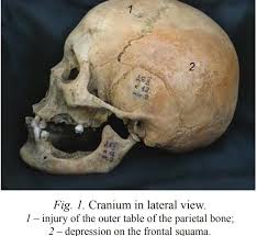 Attēlu rezultāti vaicājumam “Didymium clavus stalked”