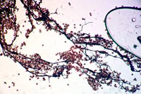 Attēlu rezultāti vaicājumam “Amaurochaete atra young”
