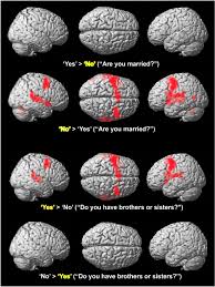 Image result for no brain