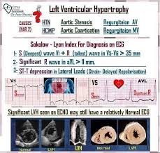 Image result for  ^ L V [ h    