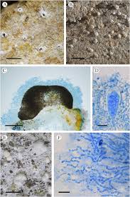 Attēlu rezultāti vaicājumam “Arthonia byssacea”