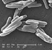 Mycobacterium <b>tuberculosis</b>