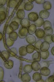 Attēlu rezultāti vaicājumam “Trichia scabra sessile”