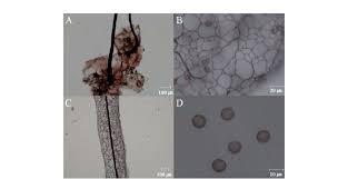 Attēlu rezultāti vaicājumam “Stemonitis flavogenita spores”
