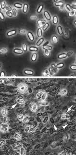 Attēlu rezultāti vaicājumam “Badhamia affinis var. microspora macro”