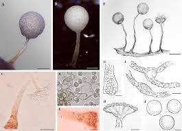 Attēlu rezultāti vaicājumam “Arcyria globosa spores”