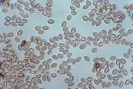 Attēlu rezultāti vaicājumam “Stemonitis fusca”