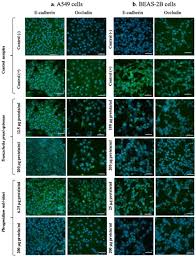 Attēlu rezultāti vaicājumam “Tranzschelia pruni-spinosae spores”