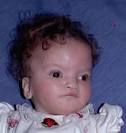 Wolf-Hirschhorn syndrome is