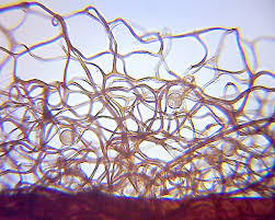 Attēlu rezultāti vaicājumam “Stemonitis marjana macro”