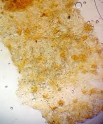 Attēlu rezultāti vaicājumam “Lycogala cf. oleocrystalliferum”