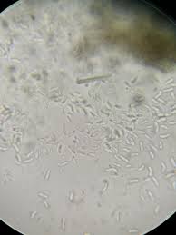 Attēlu rezultāti vaicājumam “Pleurosticta acetabulum”