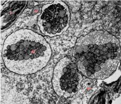 Attēlu rezultāti vaicājumam “Lophozia ventricosa”