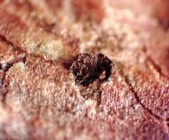 Attēlu rezultāti vaicājumam “Badhamiopsis macrospora”