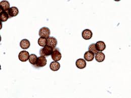 Attēlu rezultāti vaicājumam “Didymium squamulosum spores”