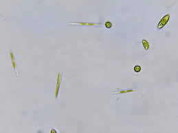 Attēlu rezultāti vaicājumam “Lycogala sphaeroconicum macro”