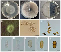 Attēlu rezultāti vaicājumam “Lycogala botrydium spores”