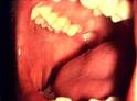 Detecting Oral Cancer: A Guide for Health Care Professionals