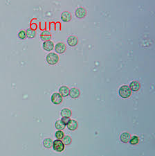 Attēlu rezultāti vaicājumam “Lycogala ustulatum”
