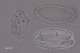Attēlu rezultāti vaicājumam “Mycoblastus sanguinarius”