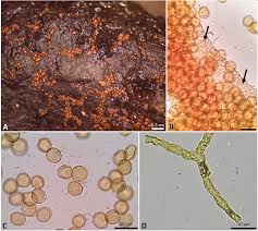 Attēlu rezultāti vaicājumam “Perichaena corticalis sessile”