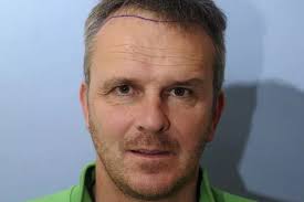 Image result for Liverpool Transplant FC