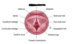 Attēlu rezultāti vaicājumam “Cribraria piriformis”