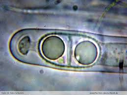 Attēlu rezultāti vaicājumam “Acrocordia gemmata”