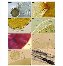 Attēlu rezultāti vaicājumam “Enteridium variabile spores”
