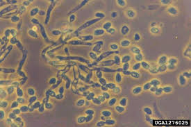 Attēlu rezultāti vaicājumam “Diachea muscorum spores”