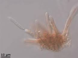 Attēlu rezultāti vaicājumam “Mycosphaerella millegrana”