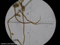 Attēlu rezultāti vaicājumam “Trichia botrytis var. cerifera”