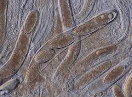 Attēlu rezultāti vaicājumam “Pertusaria leioplaca”