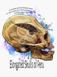 Image result for elongated skulls