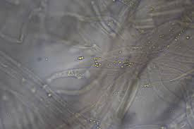 Attēlu rezultāti vaicājumam “Ombrophila violacea spores”