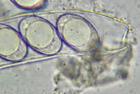 Attēlu rezultāti vaicājumam “Octospora humosa”