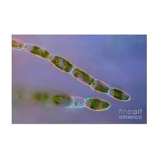 Attēlu rezultāti vaicājumam “Trentepohlia sp.”