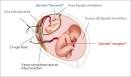 de <b>transfusión feto fetal</b>