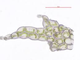 Attēlu rezultāti vaicājumam “Leiocolea collaris”