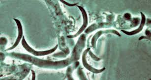 Attēlu rezultāti vaicājumam “Badhamia bethelii spores”