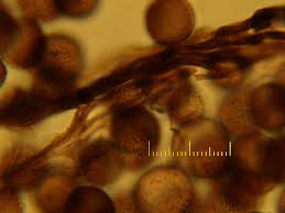 Attēlu rezultāti vaicājumam “Amaurochaete atra macro”