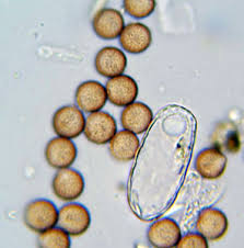 Attēlu rezultāti vaicājumam “Lycogala ustulatum macro”