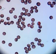 Attēlu rezultāti vaicājumam “Amaurochaete fusiformis spores”