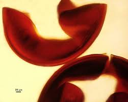 Attēlu rezultāti vaicājumam “Licea castanea spores”