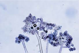 Attēlu rezultāti vaicājumam “Myriosclerotinia scirpicola”