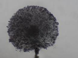 Attēlu rezultāti vaicājumam “Lamproderma debile spores”